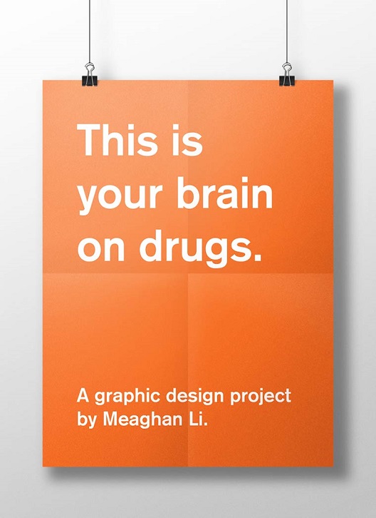Вашиот мозок на дроги